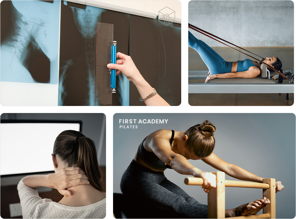 일자목, 거북목교정운동